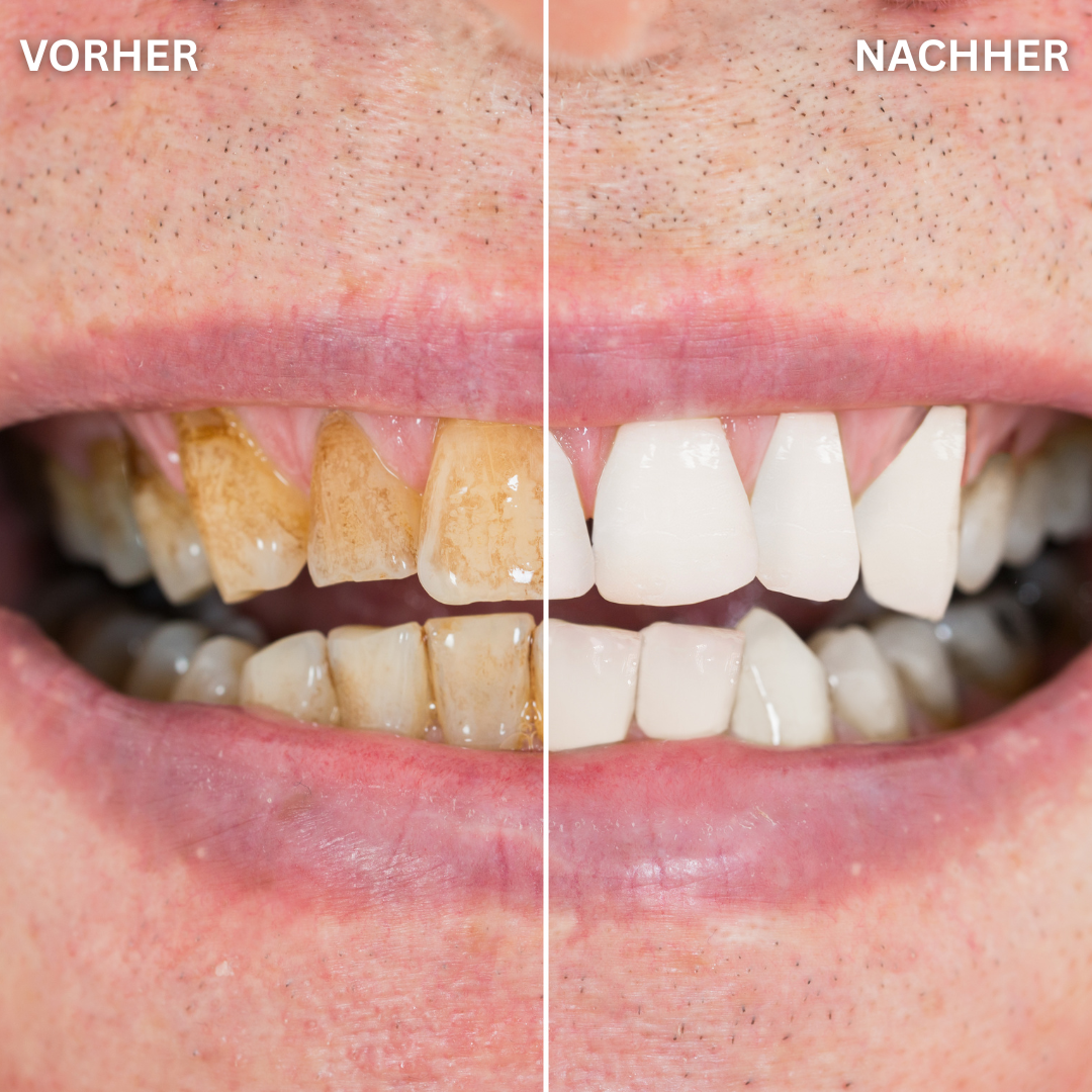 LIONAVI Gesichtstücher